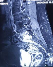 Pre-operation image 1