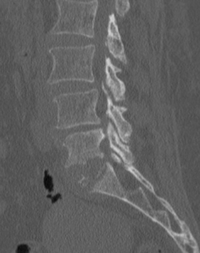 Pre-operation image 3