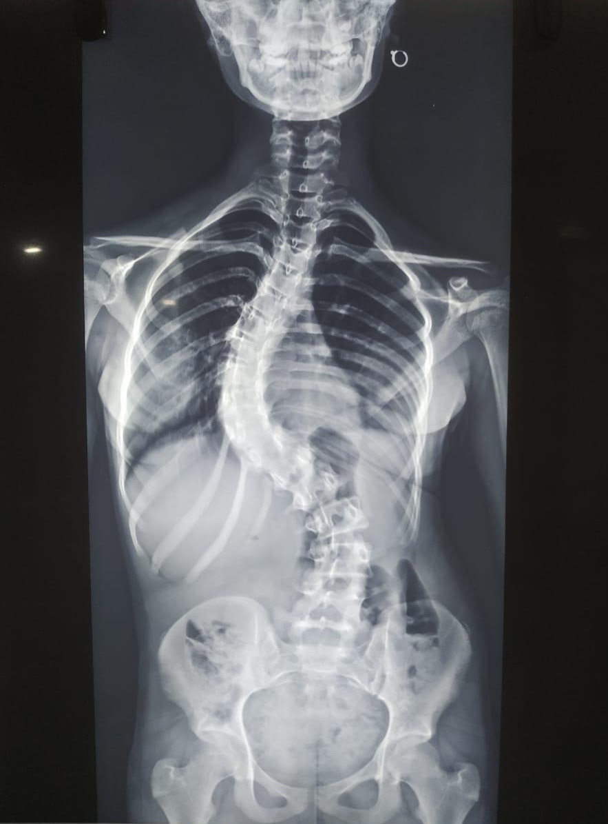 Pre-operation image 1